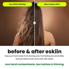 Eskiin Filtered Showerhead With Filters For Healthy Hair & Skin